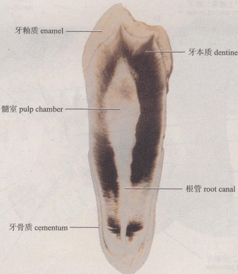 图1-1-7 牙磨片(低倍镜)